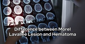Difference between Morel Lavallee Lesion and Hematoma